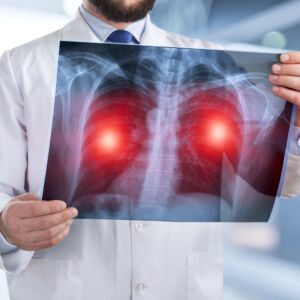Pneumologie, La broncho-pneumopathie chronique obstructive