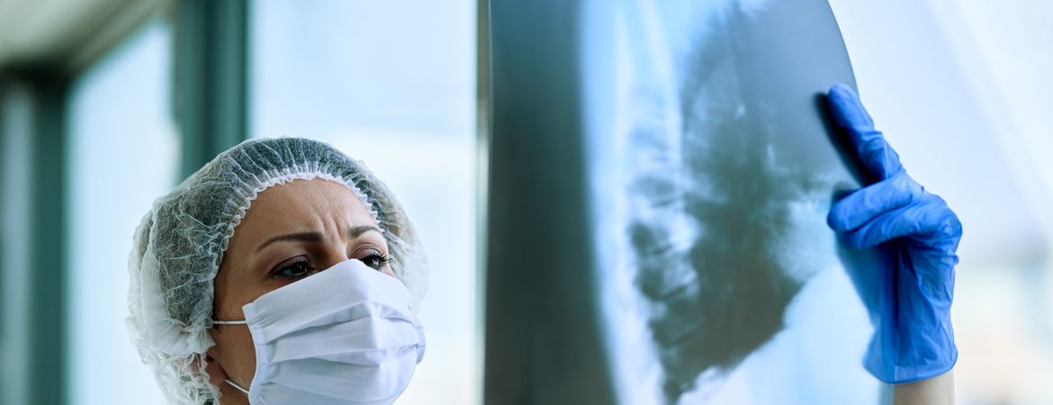 Comprendre le cancer du poumon : symptômes, causes et traitements