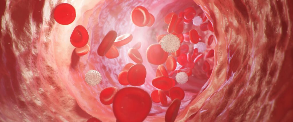 Qu'est-ce que le cancer du sang et comment le traiter