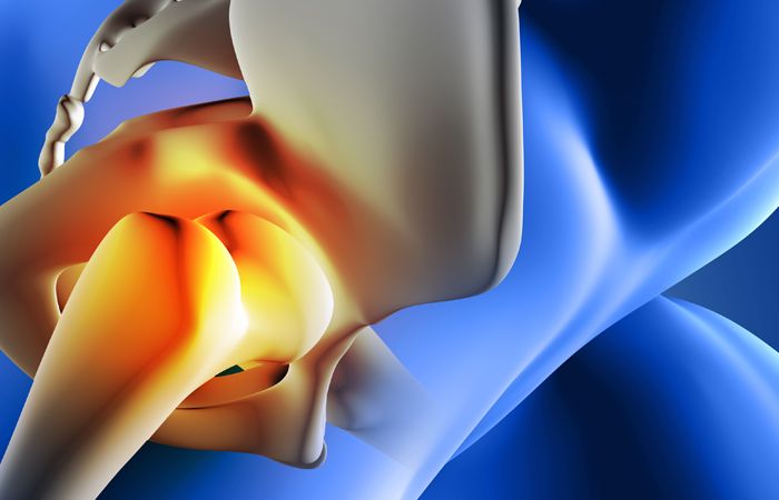 Les différentes techniques de chirurgie de la hanche expliquées