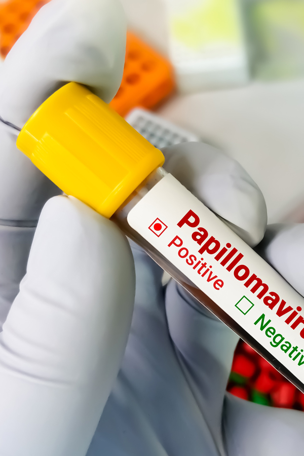 Sensibiliser à propos du Papillomavirus